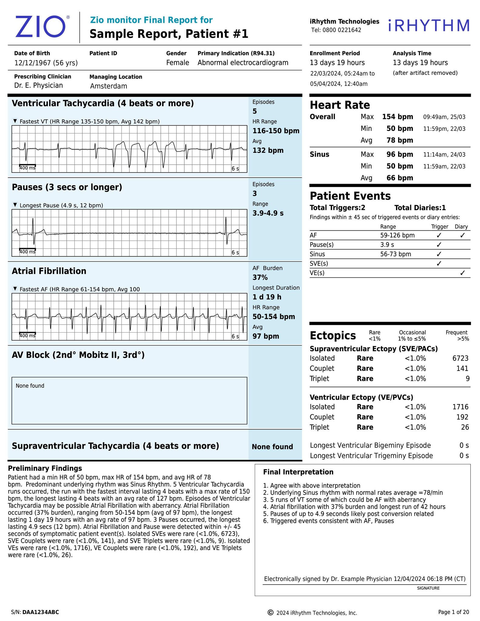 EU Zio monitor Sample Report